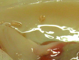 寄生虫 ニベリニア この 白い スゴイ奴ら と 共に 魚類には 寄生虫が多い イカなら ニベリニア カツオなら テンタクラリア 新鮮なものほど ついていることが多いという 人体には害のないものが多いらしいが アニサキス はちょっとめんどうなよう